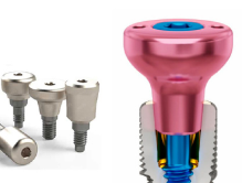 Bảng giá trồng răng Implant tại bệnh viện răng hàm mặt.