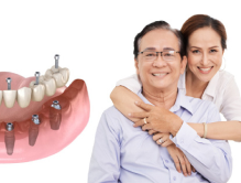Copy of Kỹ thuật Implant toàn hàm all-on-6 cường lực cao cấp bậc nhất.